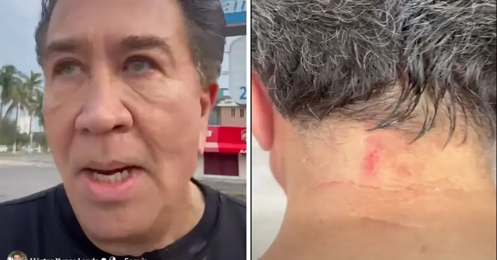 Asaltan a Héctor Yunes mientras corría en el bulevar de Boca del Río Asaltan a Héctor Yunes mientras corría en el bulevar de Boca del Río