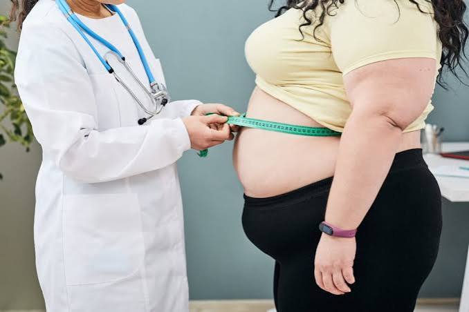 Veracruz, quinto lugar nacional en casos de obesidad Veracruz, quinto lugar nacional en casos de obesidad
