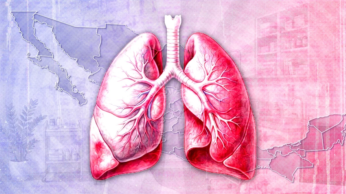 No sólo el COVID-19: México supera los 10 mil casos de tuberculosis, ¿a qué estados afecta más? No sólo el COVID-19: México supera los 10 mil casos de tuberculosis, ¿a qué estados afecta más?